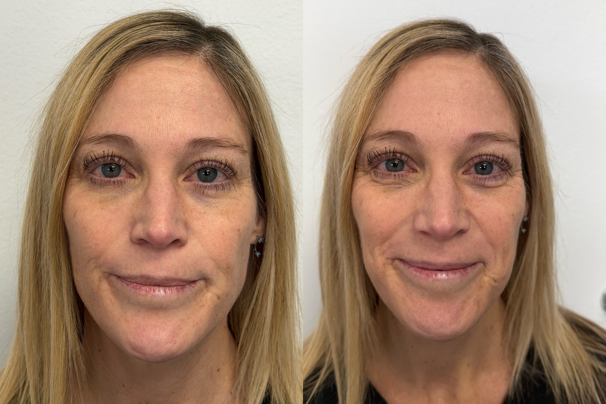 Featured treatment image